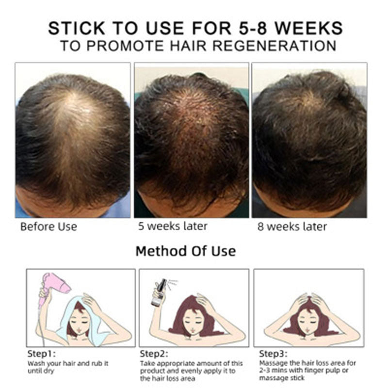 La Croissance des cheveux D'huile Cheveux Croissance Huile Oem Soins Des Cheveux Huile Essentielle