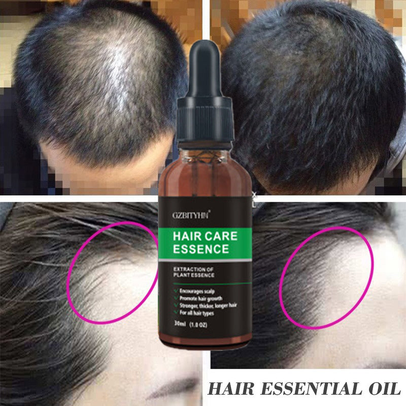 La Croissance des cheveux D'huile Cheveux Croissance Huile Oem Soins Des Cheveux Huile Essentielle
