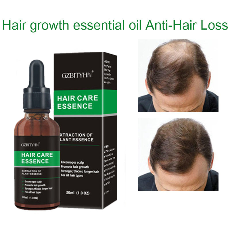 La Croissance des cheveux D'huile Cheveux Croissance Huile Oem Soins Des Cheveux Huile Essentielle